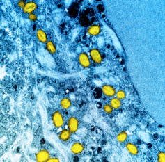 Yellow ovals (monkeypox virus particles) spread over a blue cell background