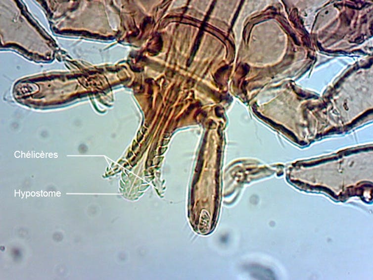 Photo en microscopie des pièces piqueuses d’une tique appartenant au genre Ixodes, avec au centre l’hypostome denticulé.