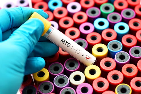 The key to treating TB may be in a common carbohydrate. What we know so far