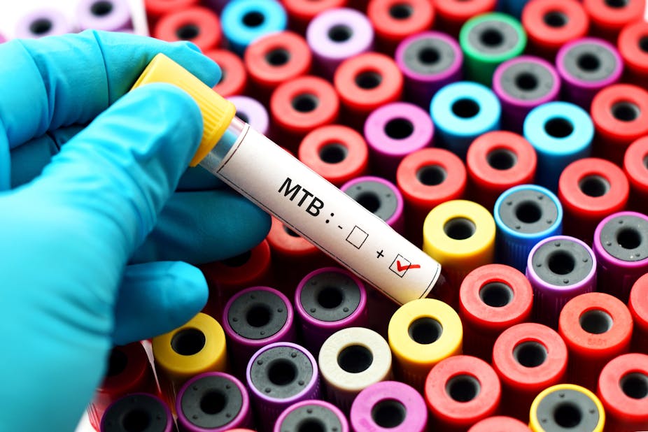 A hand in a blue surgical glove holds a vial that reads "MTB" on the side above many more vials with colourful lids