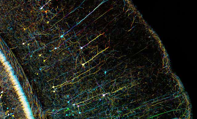 Microscopie colorée de neurones