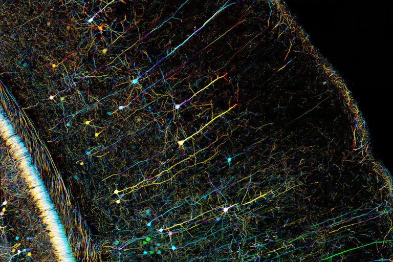 Microscopie colorée de neurones