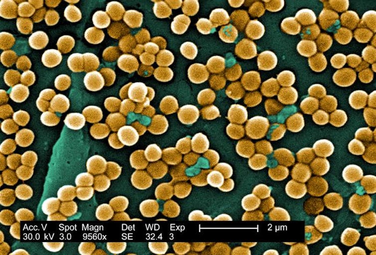 Microscopy image of Staphylococcus aureus (MRSA) bacteria