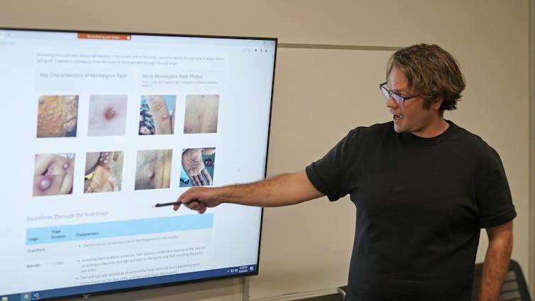 A man in a black T-shirt is pointing at a large screen showing a series of images of skin lesions.