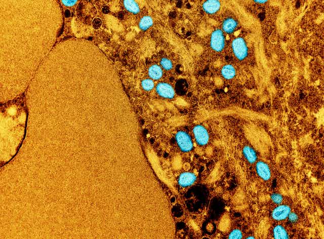 Colourized microscopic image of monkeypox virus appearing as blue ovals against an amber background