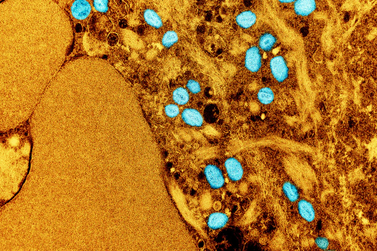 Colourized microscopic image of monkeypox virus appearing as blue ovals against an amber background
