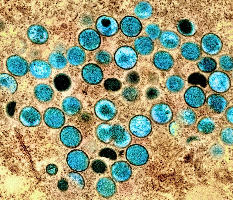 A microscope image of a bunch of blue circles in a brown-stained cell.