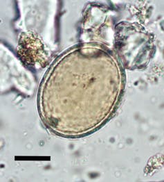 A microscopic image of a roundworm