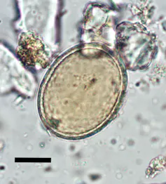 A microscopic image of a roundworm
