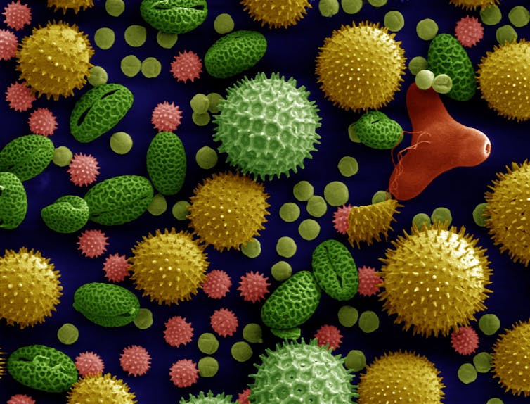 Colorized scanning electron microscope image of pollen grains from a variety of common plants