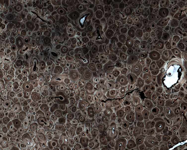 a microscopic image of bone that looks like clusters of brown circles with dark centres 