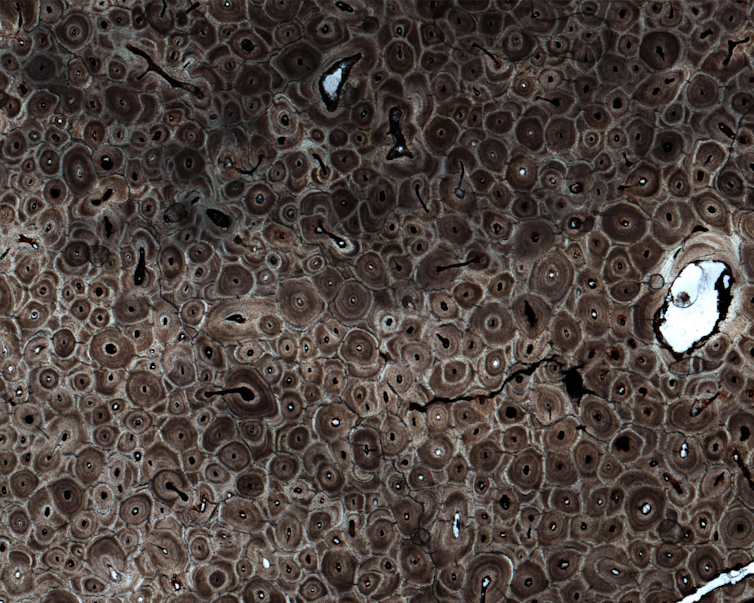 a microscopic image of bone that looks like clusters of brown circles with dark centres