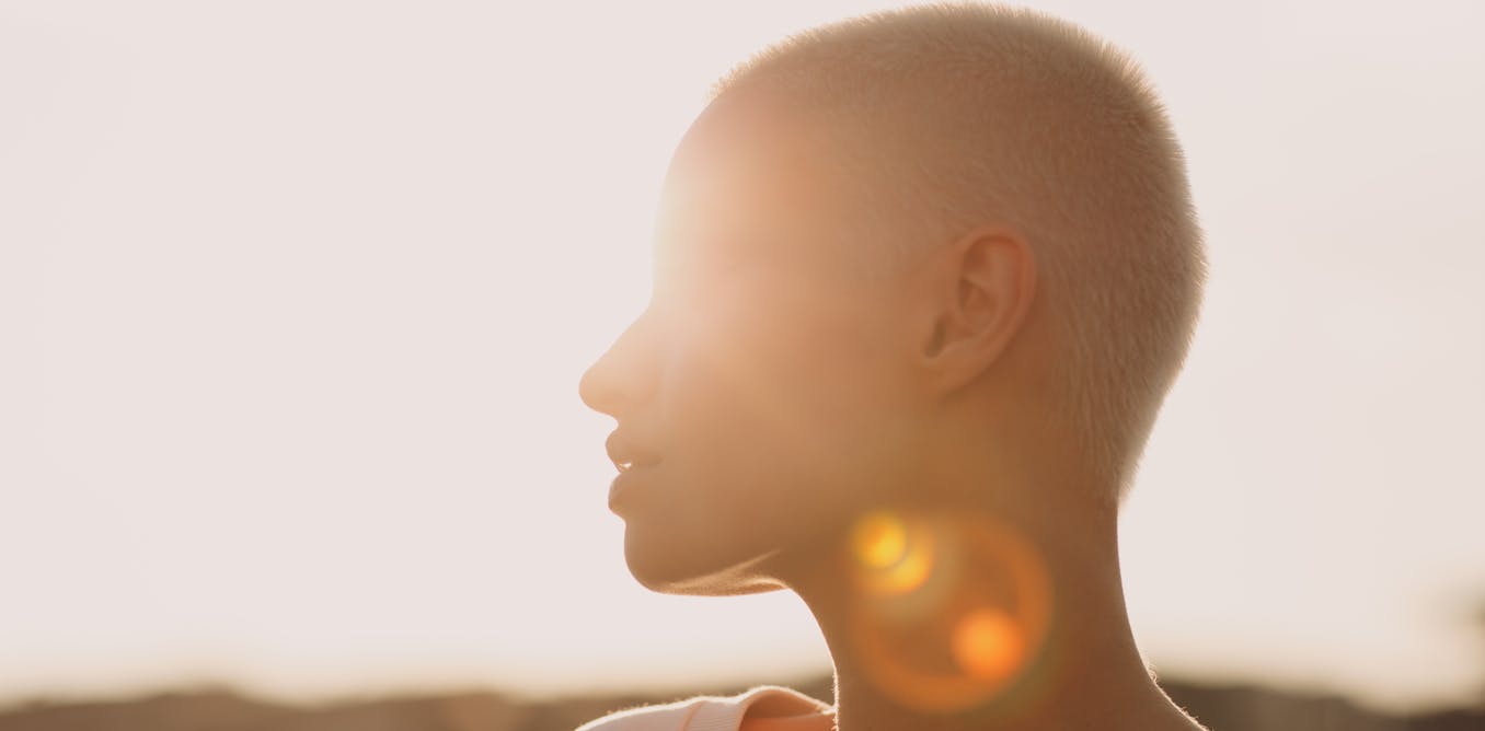 Human skin stood up better to the sun before there were sunscreens and ...