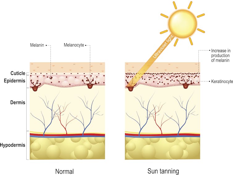 cross-sectional diagram of skin's layers with sunlight hitting the surface and showing increased production of melanin
