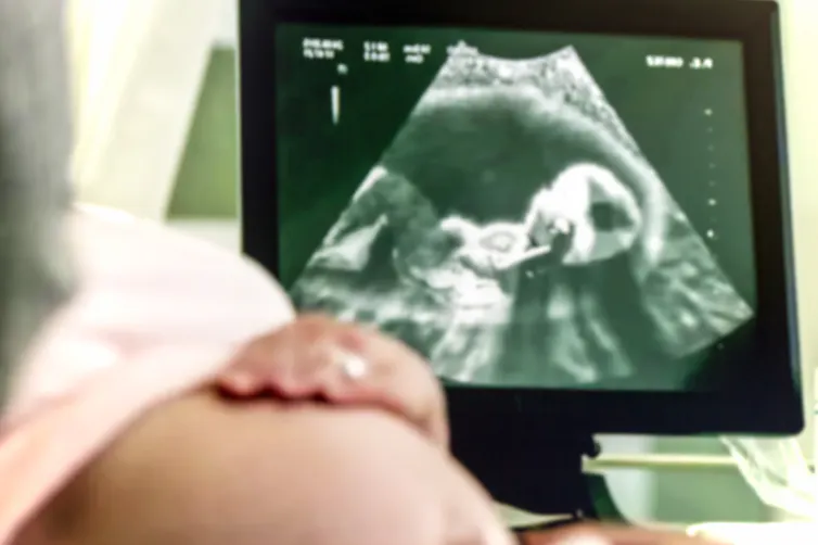 femme enceinte fait une échographie
