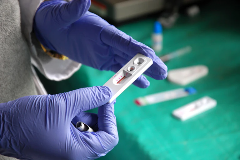 doctor wearing gloves holding an HIV test