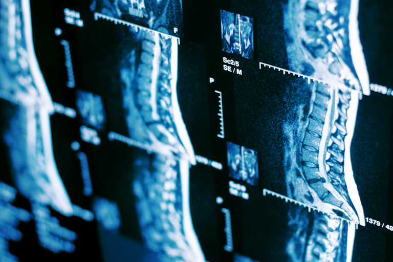 MRI scan of human spine.