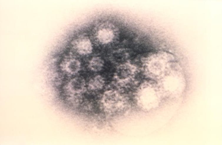 A coxsackievirus