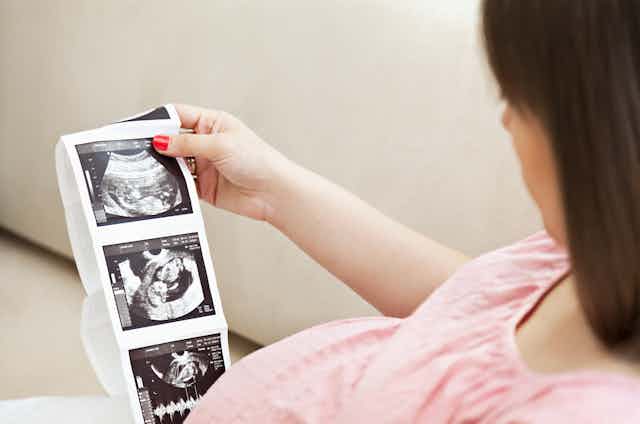 Photo d’une femme enceinte regardant des clichés d’échographie