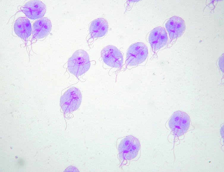 Varios parásitos flagelados teñidos de violeta vistos al microscopio.