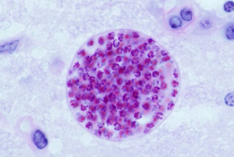 Quiste microscópico de Toxoplasma gondii desarrollado en el cerebro de un ratón. Jitinder P. Dubey / USDA