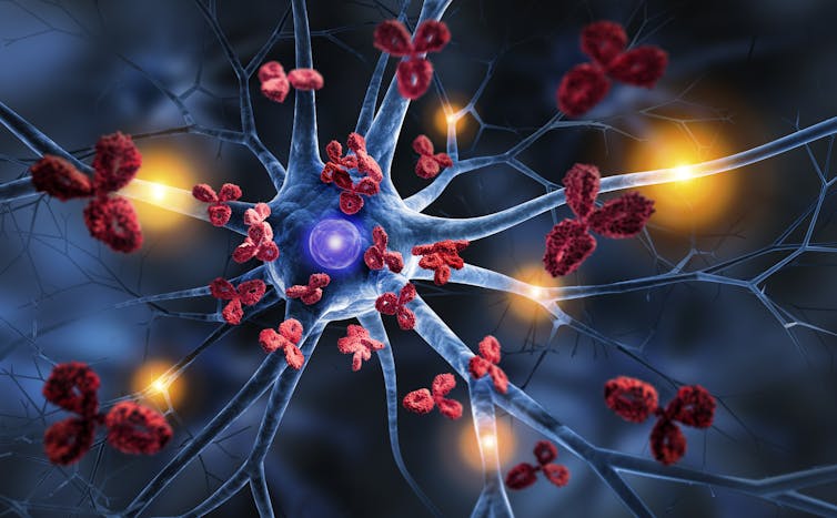 Three-dimensional illustration of a nerve cell being attacked by antibodies.