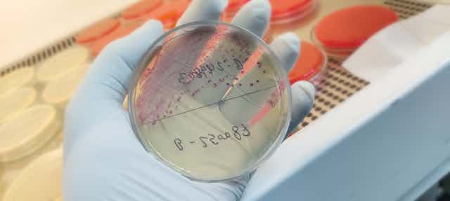 A lab technician wearing surgical gloves holds a petri dish with agar, where a urine sample has grown bacteria.