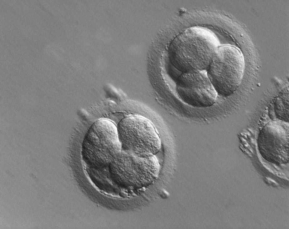 Microscopy photo of early human embryos