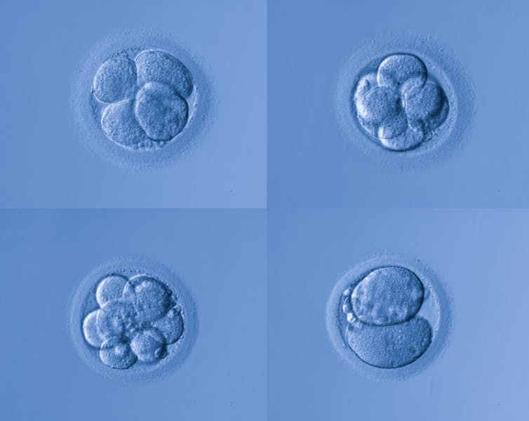 Microscopy image of four early human embryos
