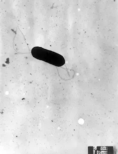 Vue d’une Listeria, avec ses cils