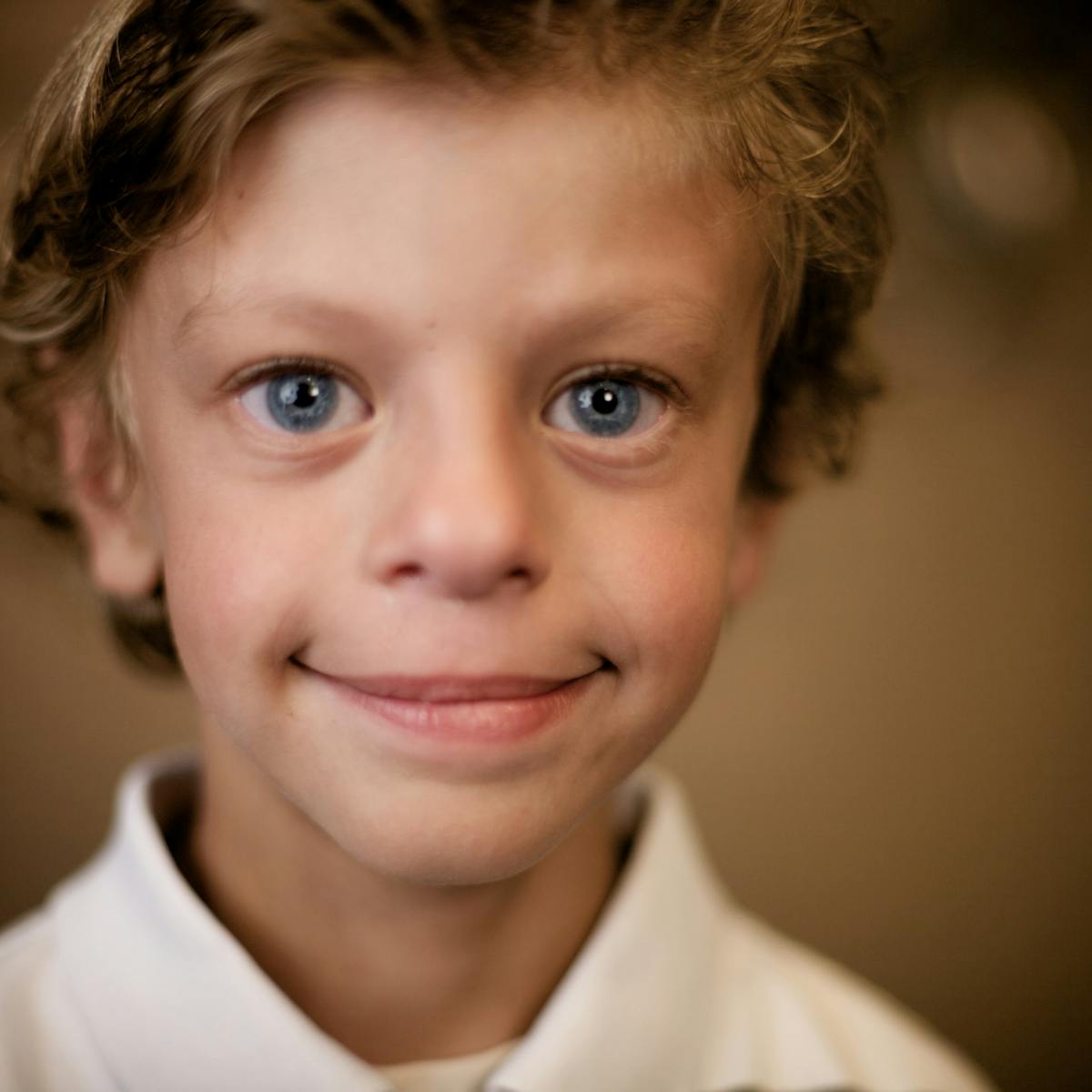 Explainer: what is Williams syndrome?