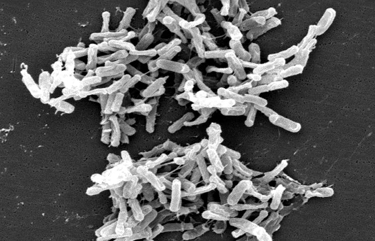 Clostridium difficile bacteria.