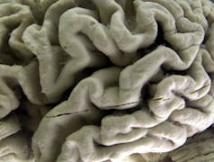 Close-up view of a section of a human brain