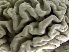 Close-up view of a section of a human brain