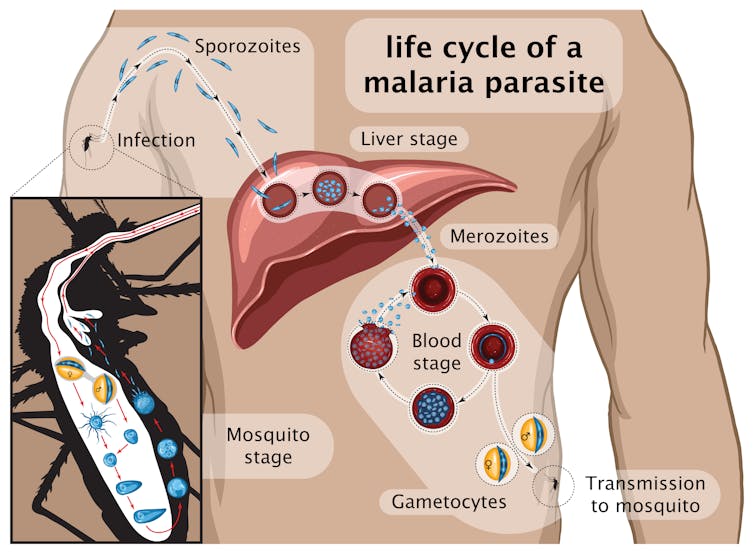 Stages of malaria.