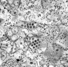 Dengue virus particle transmission electron microscopy image