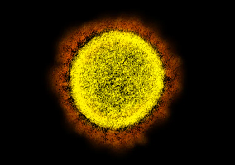 Micrographie électronique à transmission du coronavirus SARS-CoV-2, responsable de la Covid-19.