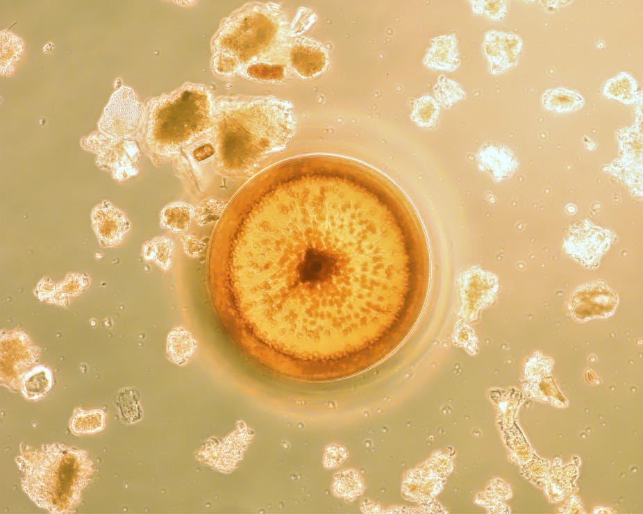Phytoplancton du genre Coscinodiscus, vu au microscope optique inversé.