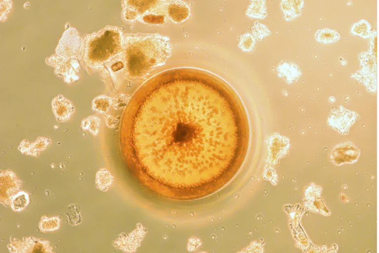 Phytoplancton du genre Coscinodiscus, vu au microscope optique inversé.