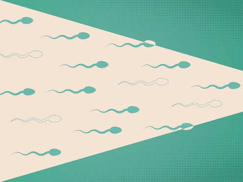 Male birth control options are in development, but a number of barriers still stand in the way