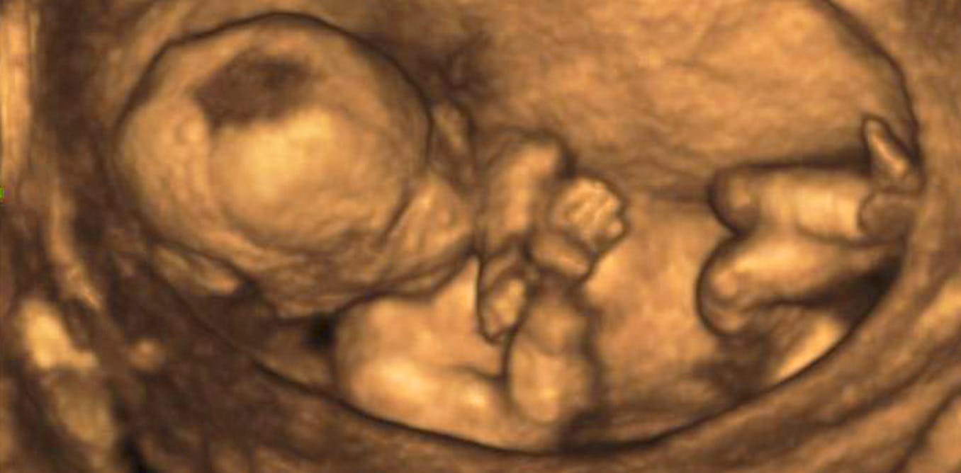 El diagnóstico prenatal, una cuestión de huevos… reptilianos