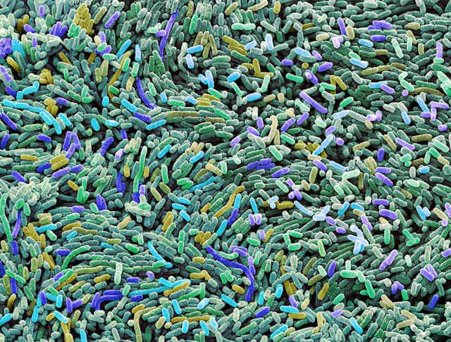 Microscopy image of colony of bacteria