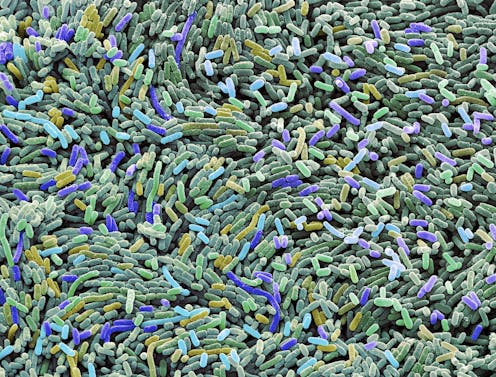Genetically engineered bacteria make living materials for self-repairing walls and cleaning up pollution