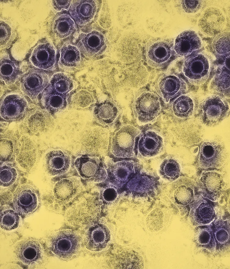 Colorised microscopic view of a virus.