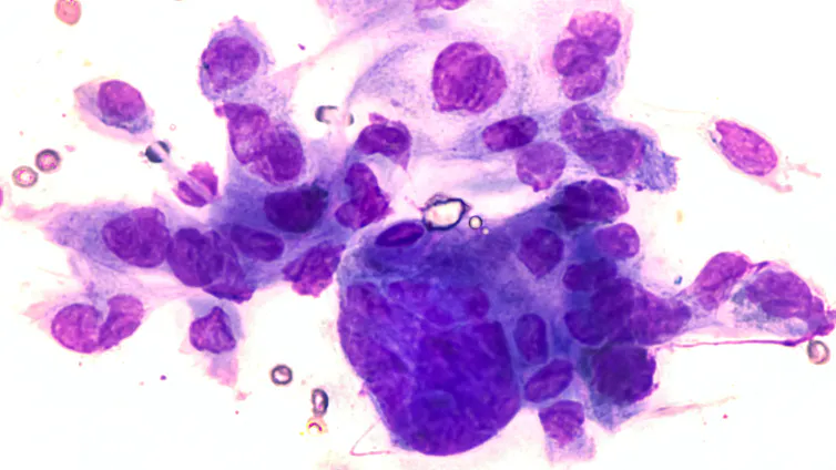 Colorised microscopic view of virus cells.