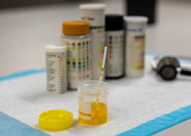 Is urine sterile? Do urine ‘therapies’ work? Experts debunk common pee ...