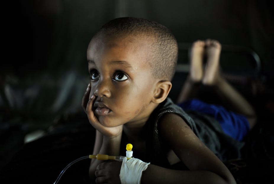 Un enfant souffrant de paludisme est soigné dans une clinique de Mogadiscio, en Somalie (2013). 