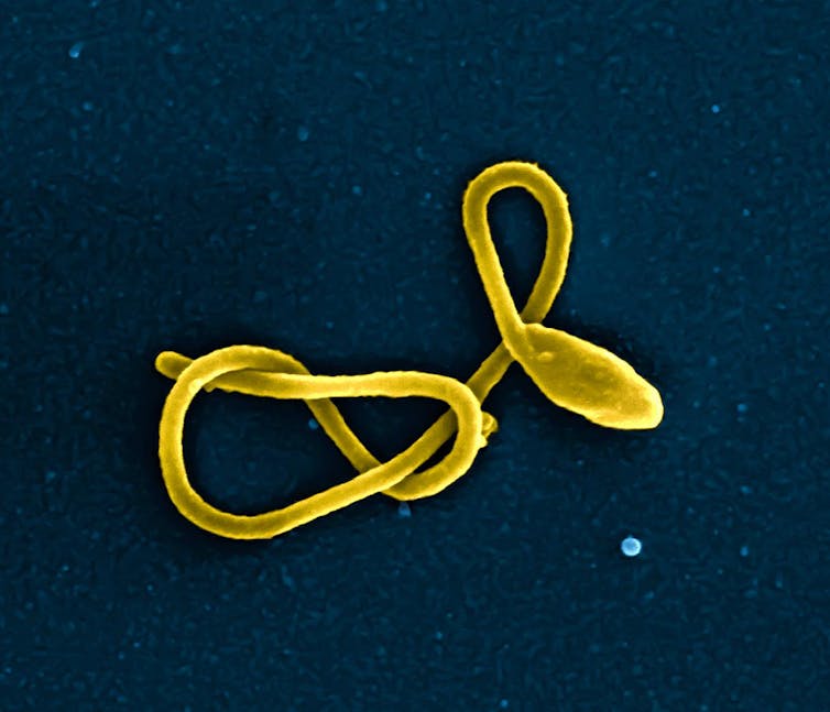 Rasterelektronenmikroskopische Aufnahme eines Ebola-Virus-Partikels (Falschfarbe).