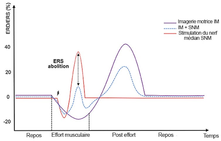 Courbe montrant le signal EEG lors de la stimulation du nerf médian et d’une intention de mouvement
