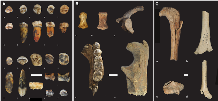 A range of bones and teeth on a dark background